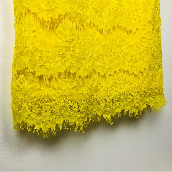 Topshop Yellow Lace Dress - Picture 5 of 9